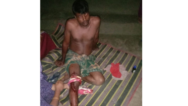 যশোরের শার্শায় ককটেল হামলায় আহত ১
