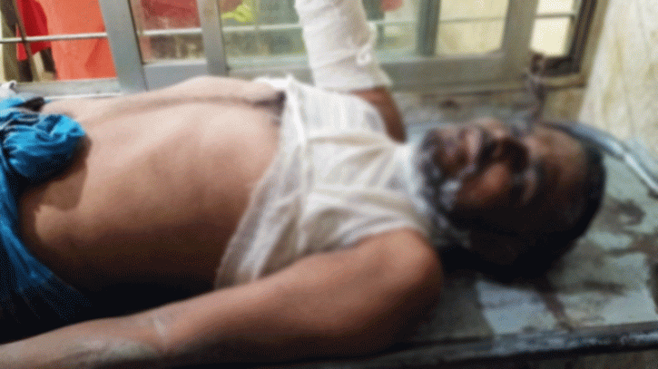 পেট্রোল ঢেলে স্ত্রীসহ নিজের শরীরে আগুন