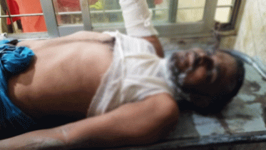 পেট্রোল ঢেলে স্ত্রীসহ নিজের শরীরে আগুন