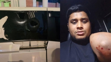 গাজীপুরে রক্তাক্ত হাসনাত, সন্ত্রাসীদের হামলা