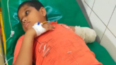 হাত বিচ্ছিন্ন: জোড়া লাগানোর ব্যয় প্রায় আট লাখ টাকা