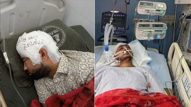 মামুনের মাথার খুলি ফ্রিজে, লাইফ সাপোর্টে সায়েম