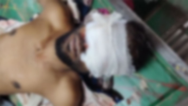 জাজিরায় অটোচালকের চোখ উপড়ে হাত-পা ভাঙার অভিযোগ